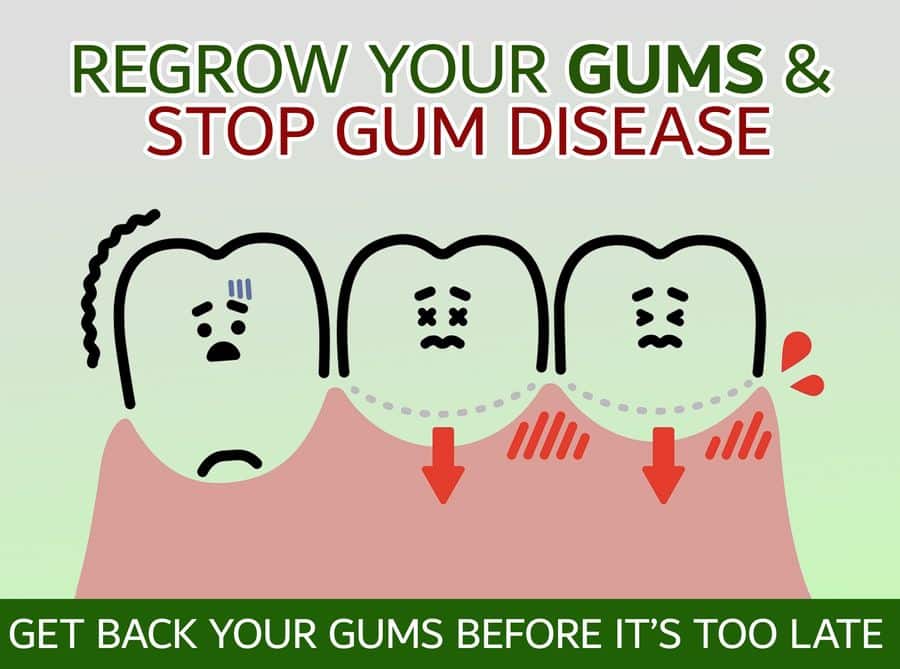 NATURES SMILE Regrow Your Gums