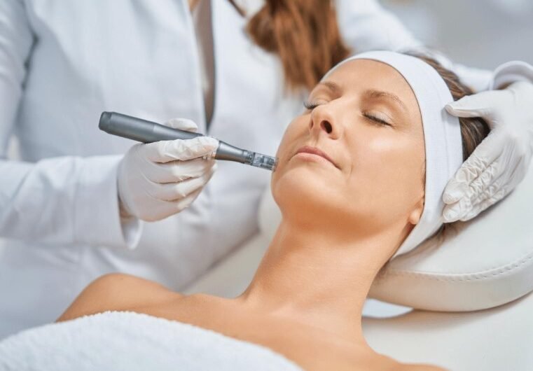 Microneedling in Lake Mary, FL: Your Most Common Questions Answered